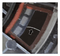 G15548915